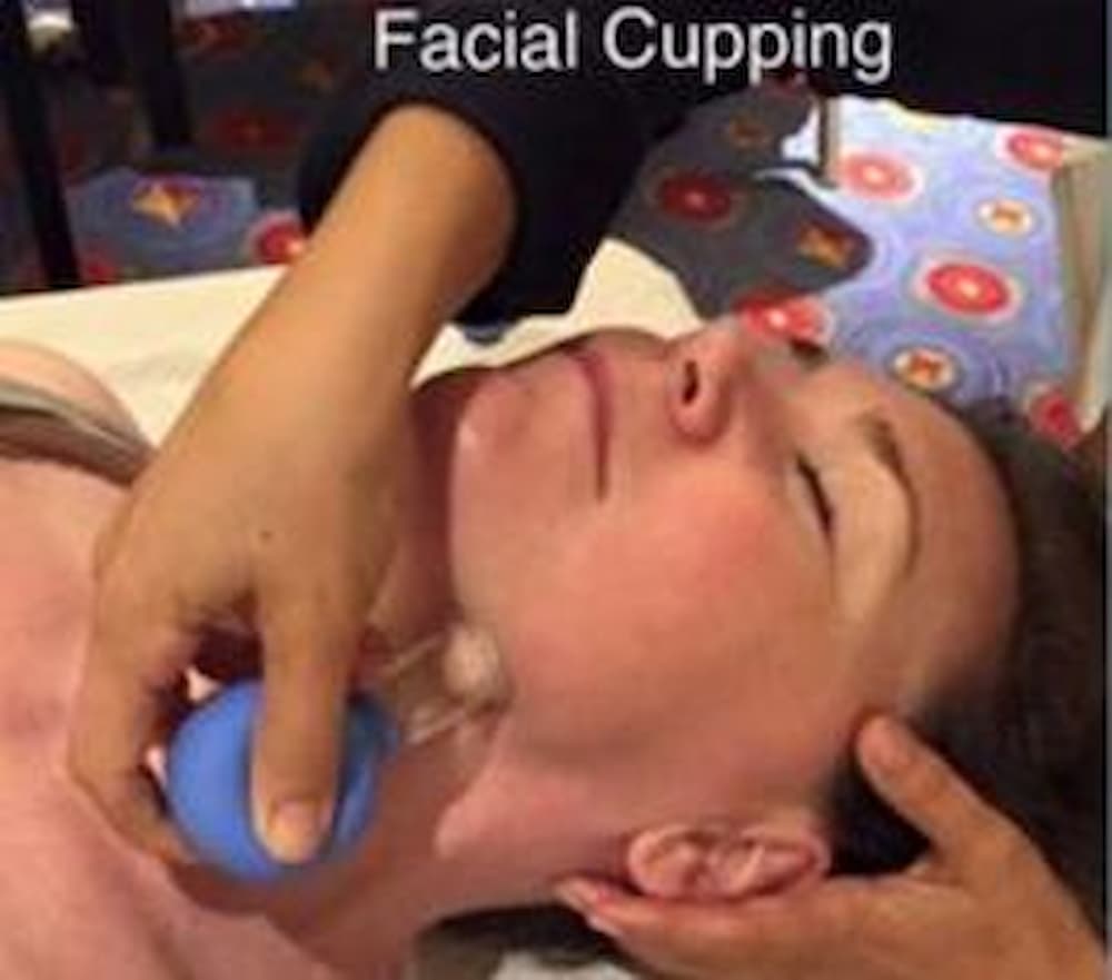 A person is getting their face and neck cupping