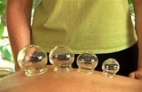 A person is holding their back while several glass balls are placed on the skin of another.
