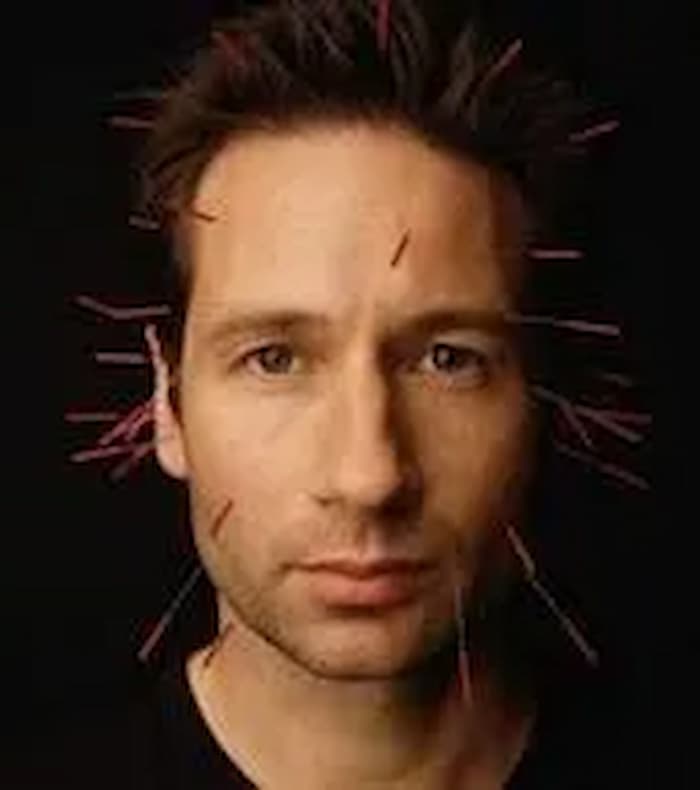 A man with many needles stuck in his head.
