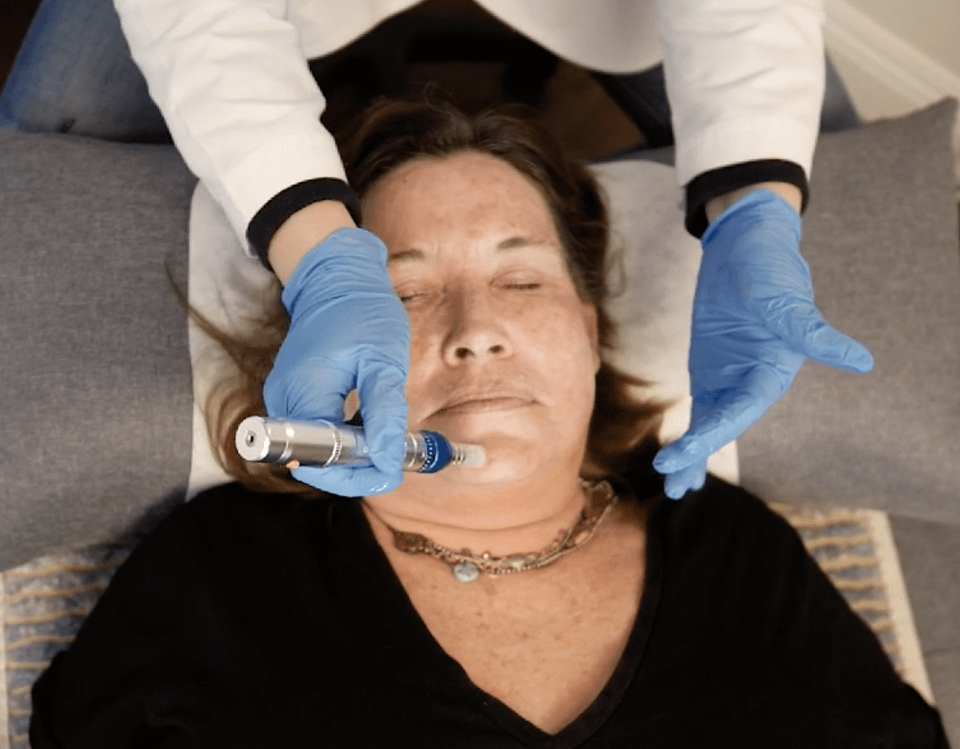 A woman getting her face waxed by an esthetician.
